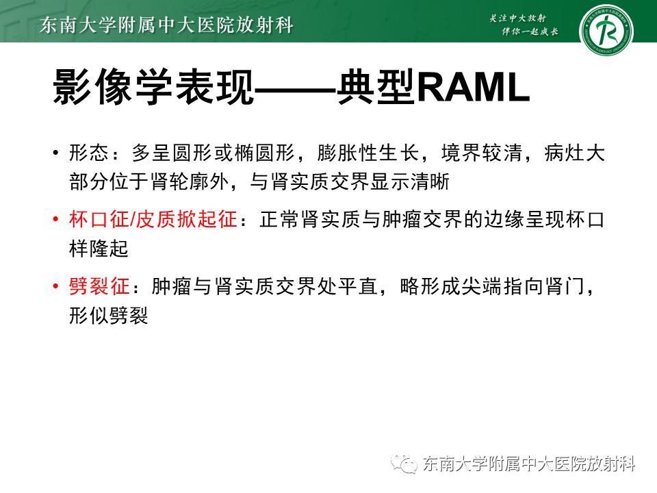 好文分享——《肾血管平滑肌脂肪瘤》