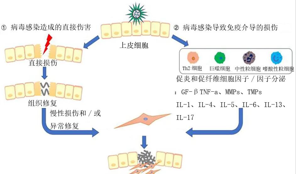 肺病毒感染,病毒感染的肺纤维化能治愈么