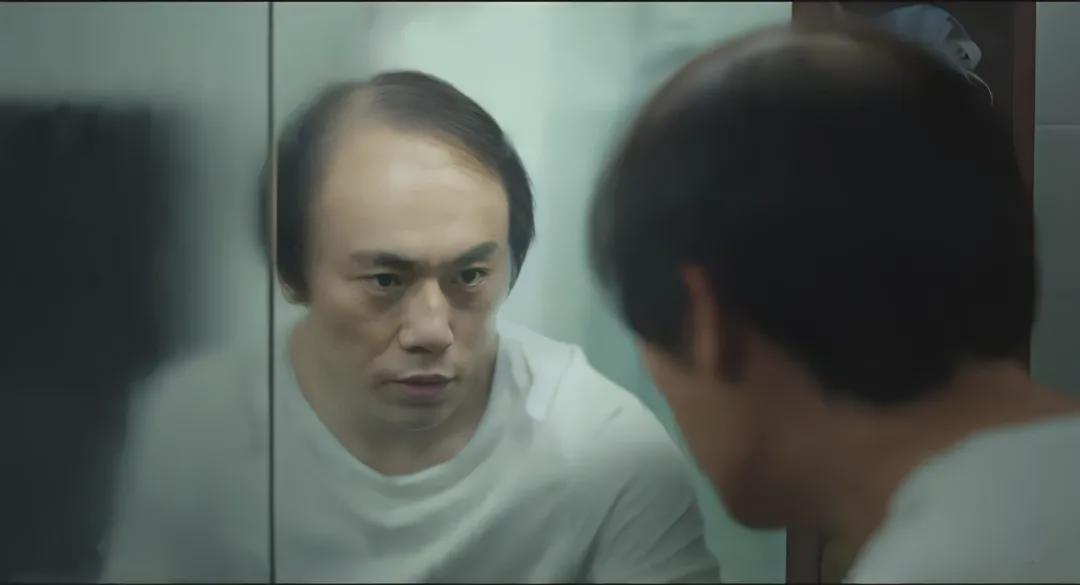 明星如何解决脱发问题,明星也扛不住脱发