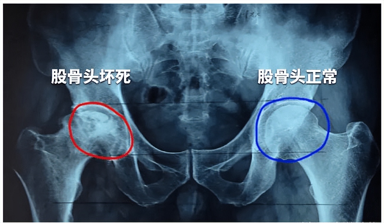 身体有病情况说明,身体有哪些疾病会引起腿痛