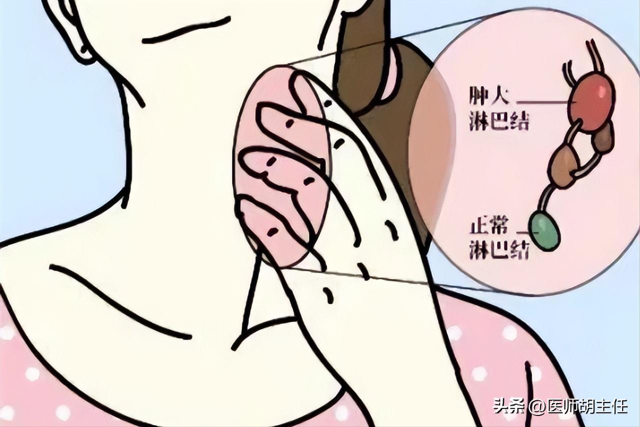 艾滋病会出现的初期皮肤病,不要把艾滋病当皮肤病