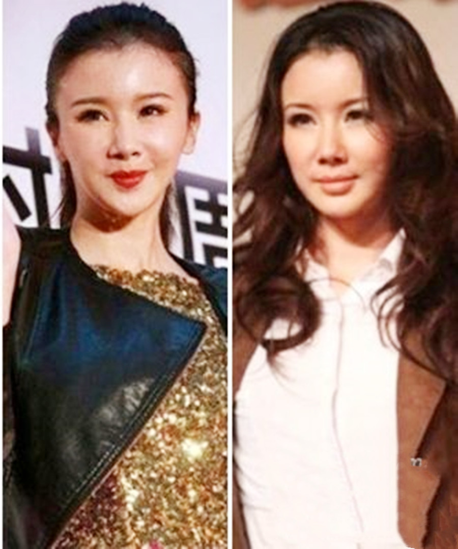 明星改善v型脸,为什么现在的女明星都是v型脸