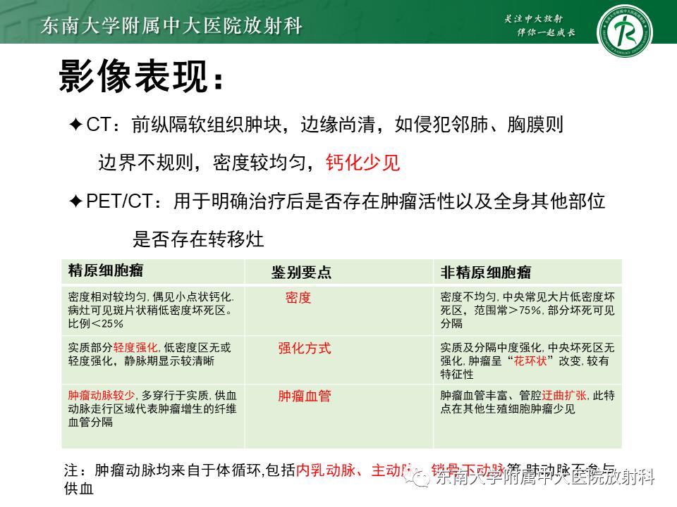 好文分享值得深思,纵隔精原细胞瘤