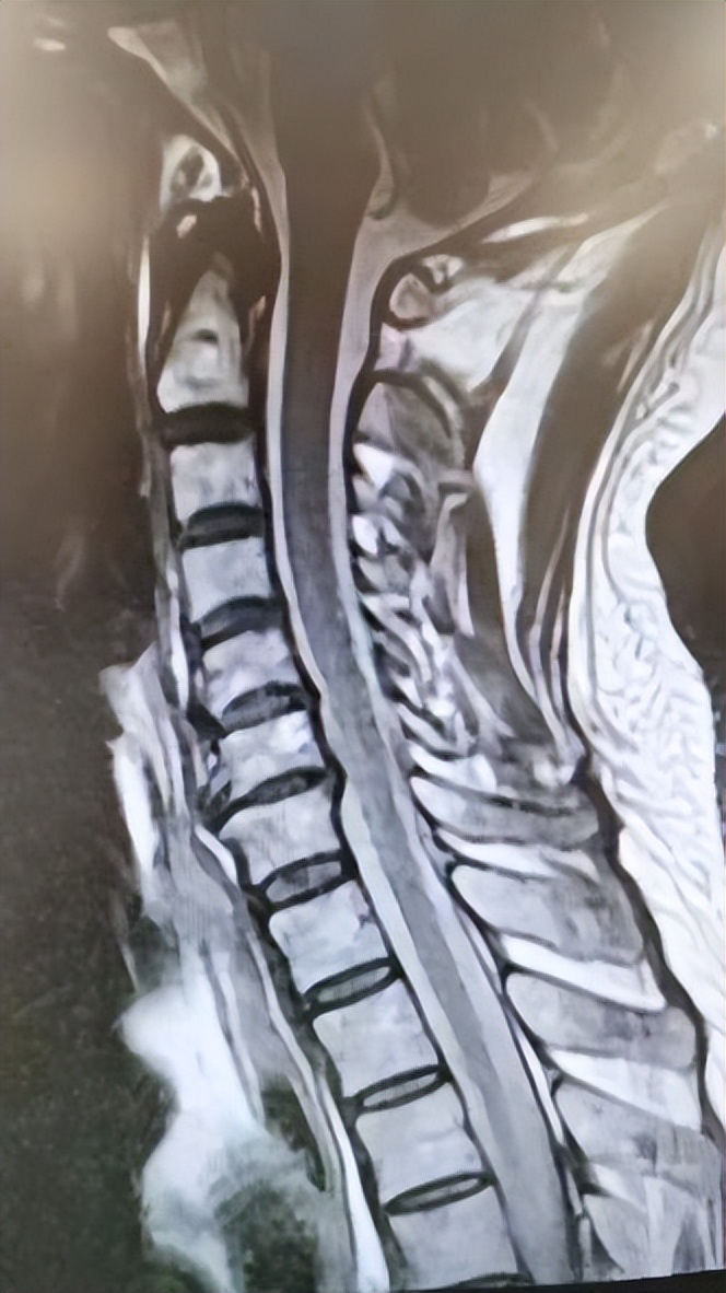 西安市红会医院北院区做微创手术,西安红会医院肌骨超声科