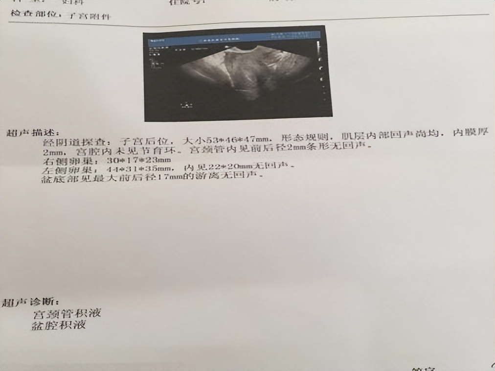 潜藏在不孕背后的“隐形杀手”？山东医生：都是盆腔炎惹的祸