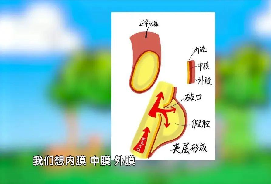 导致胸痛的三个致死因素,致死性的胸痛