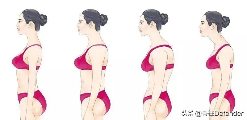 脖子肩膀酸痛的有效缓解方法,最近脖子两侧颈肩酸痛