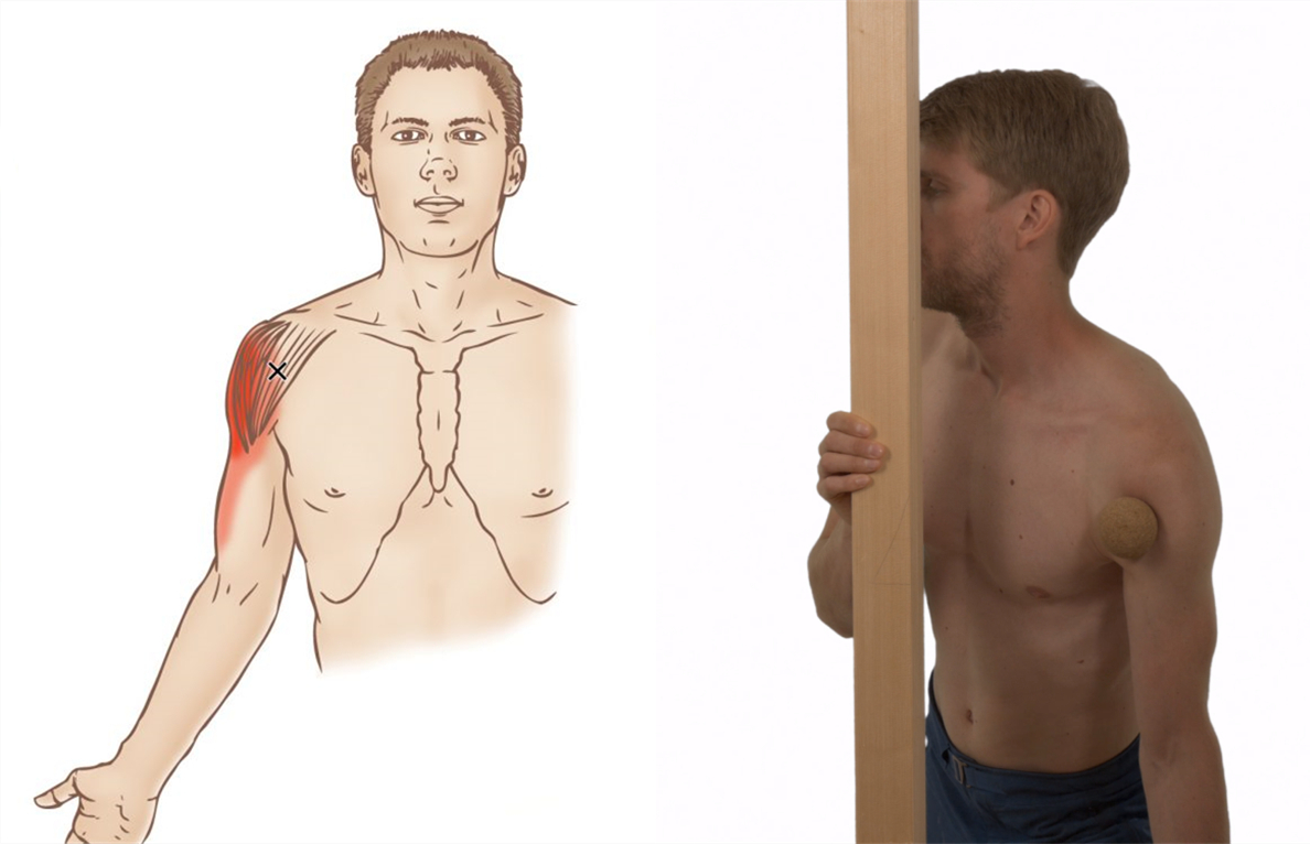 三角肌的松解方法,三角肌手法松解