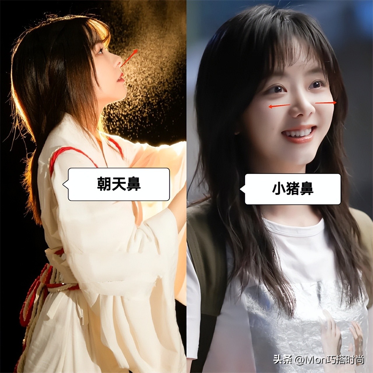 鼻子显凶显老怎么办,鼻子塌陷是不是显得人难看