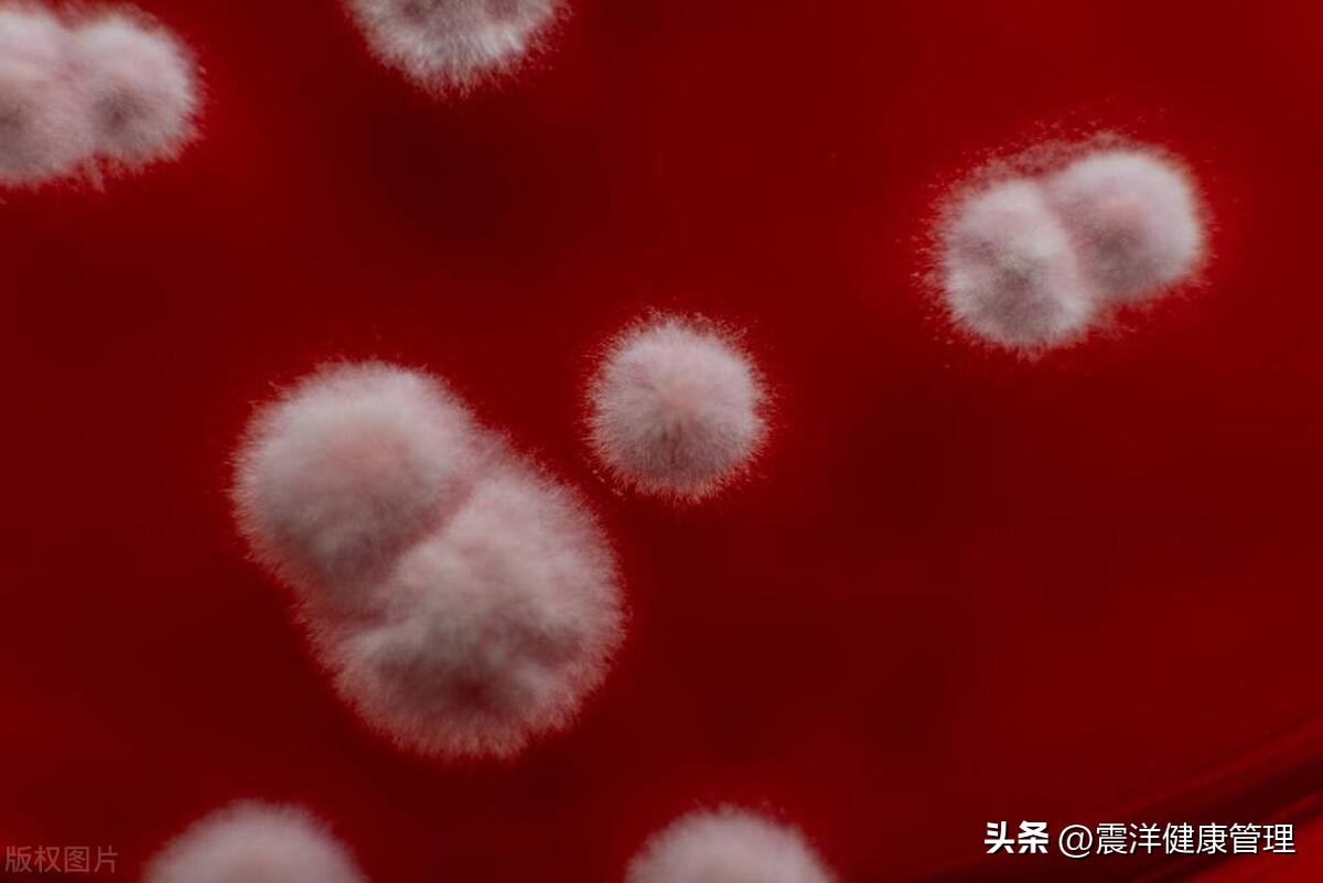 我30岁，注重卫生，但裆部异味重，差点把情人熏晕，这是咋回事？