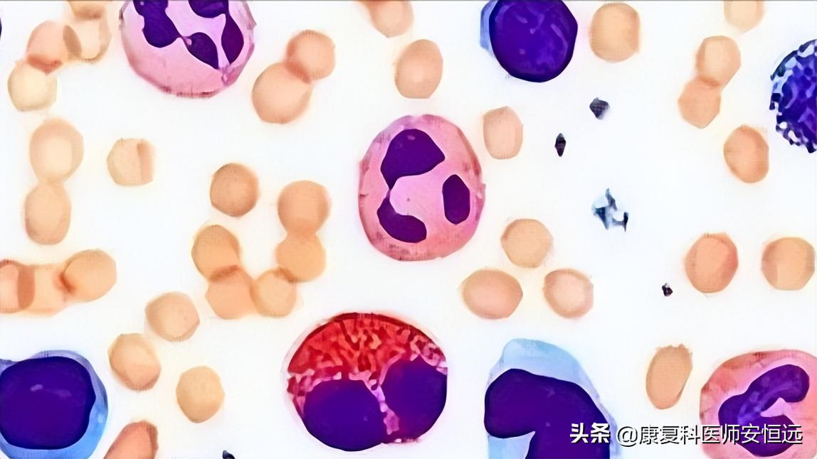 抗菌消炎药有什么不同,好的消炎药和普通消炎药的区别