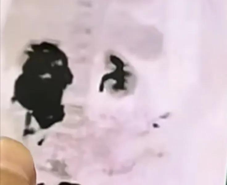 癌症针上市一针120万