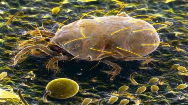 黑头白头在显微镜下怎么样,黑头可以挤出来是什么样子