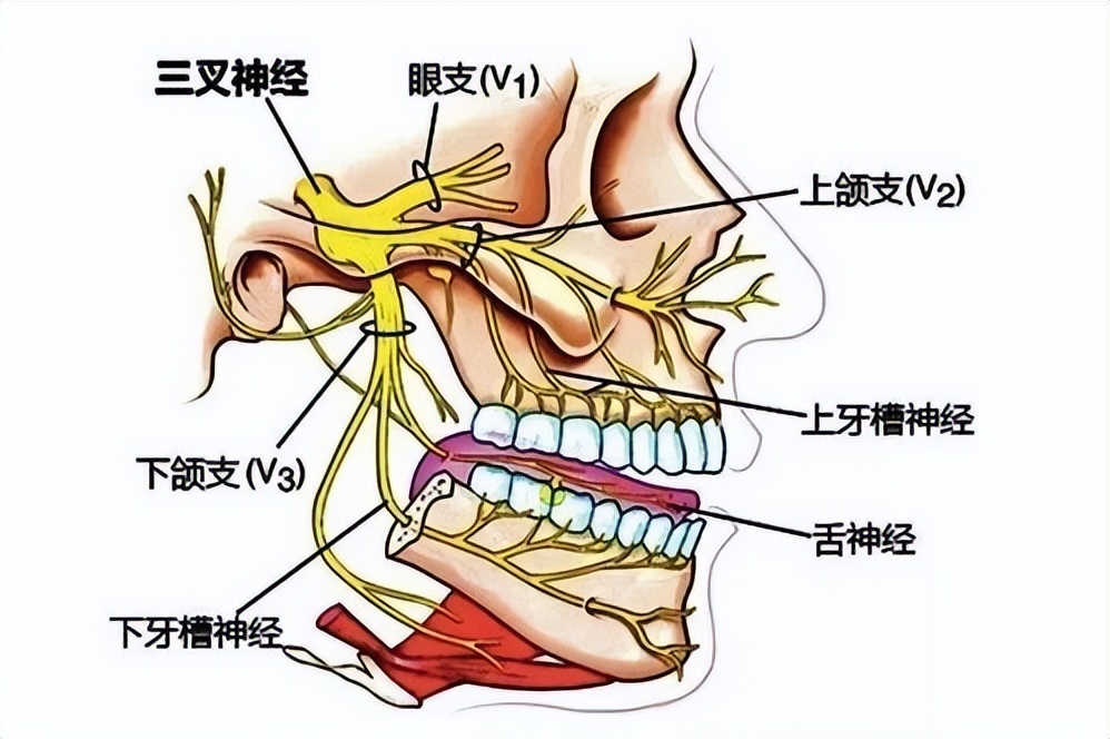头风引起头痛怎么办,头风病的病机分析