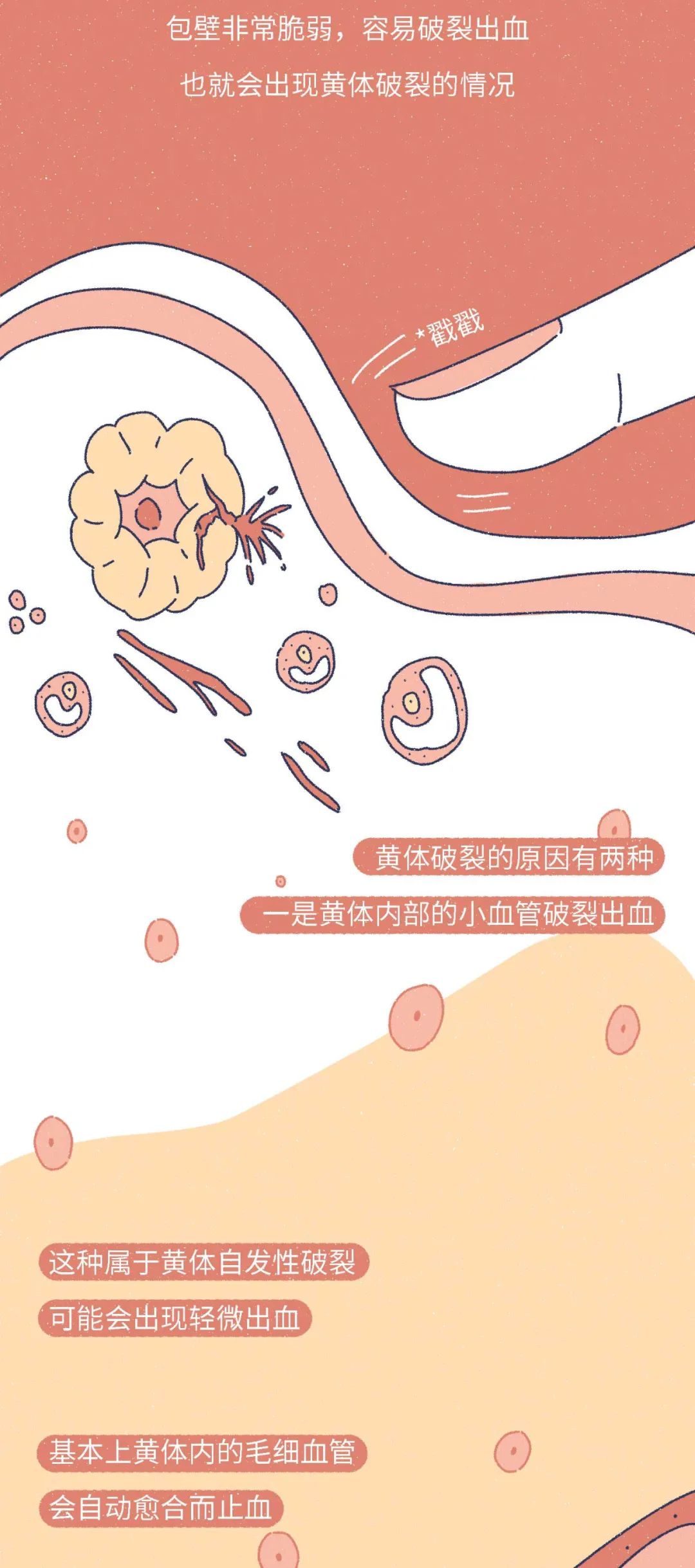 女生黄体破裂会是什么表现,什么原因会导致女性黄体破裂