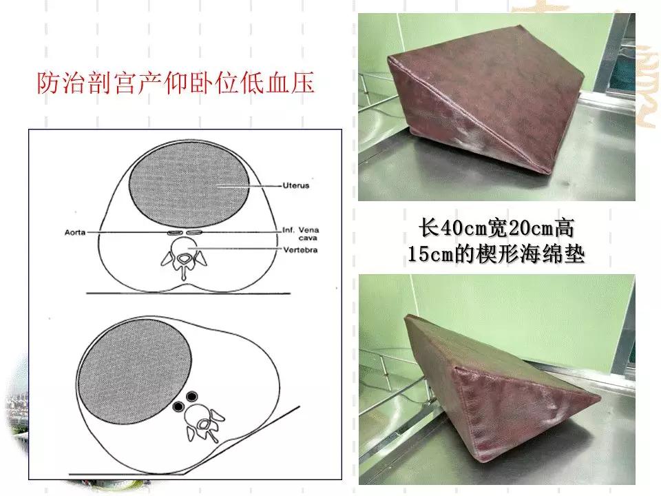 产科门诊给病人宣教课件,产科课件视频