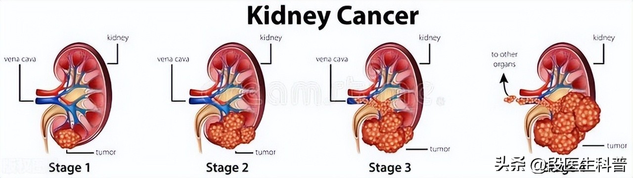 非感染性发热,感染性发热与非感染性发热的鉴别