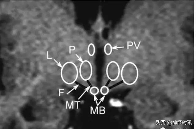 下丘脑及垂体解剖结构,下丘脑解剖和机能特点英文版