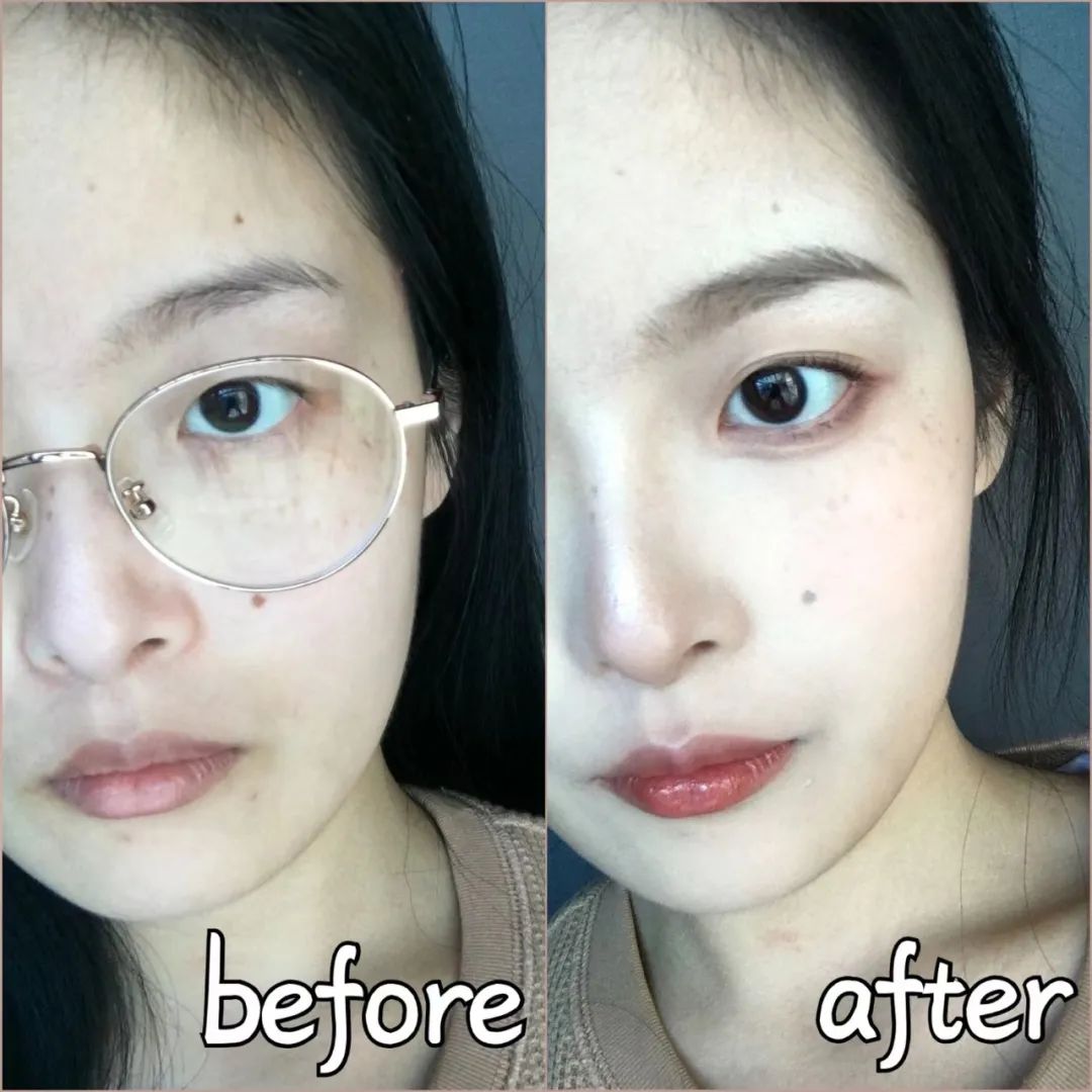 杨超越整过容吗,杨超越有没有整过容