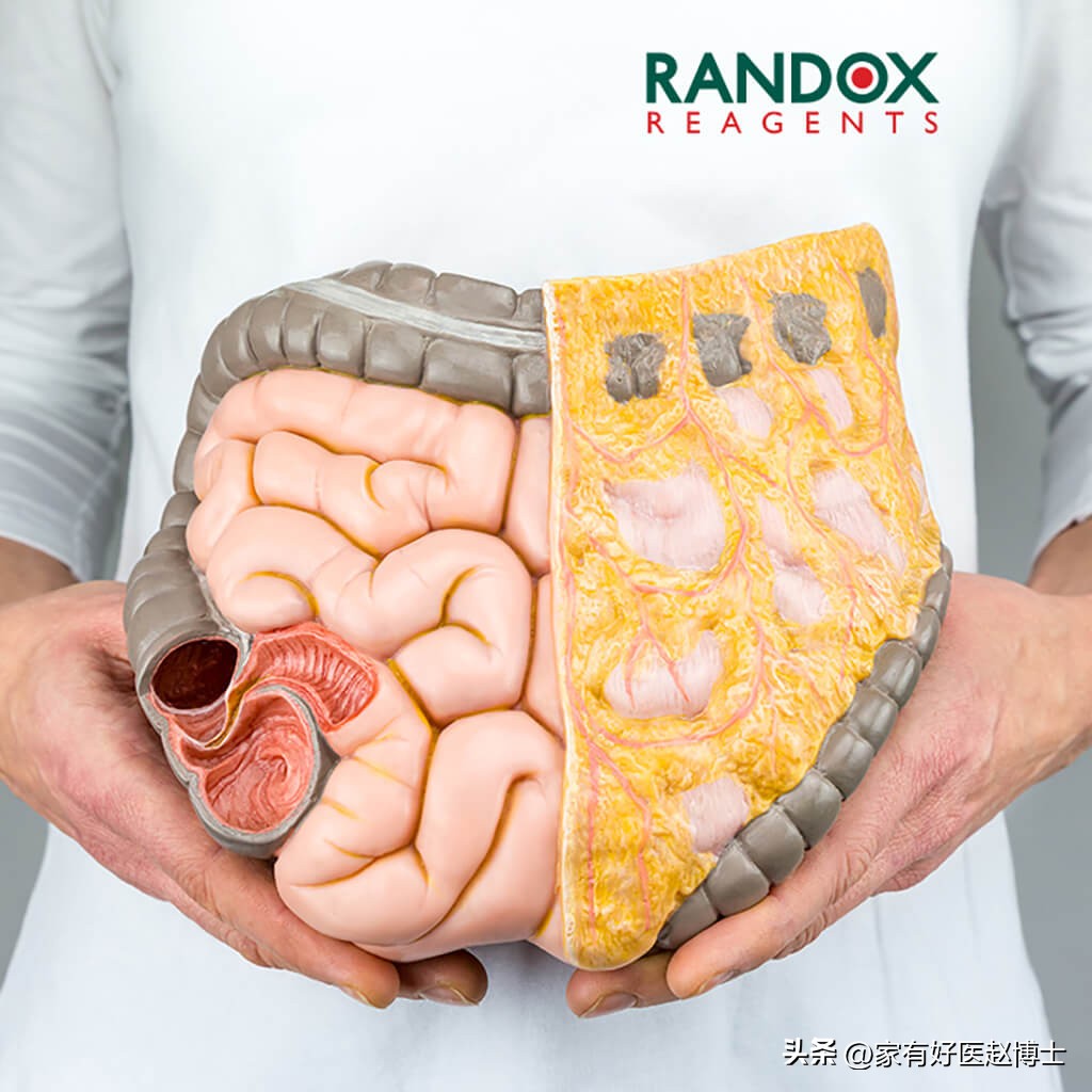 胰岛细胞治疗糖尿病最新方法,糖尿病患者保护心血管