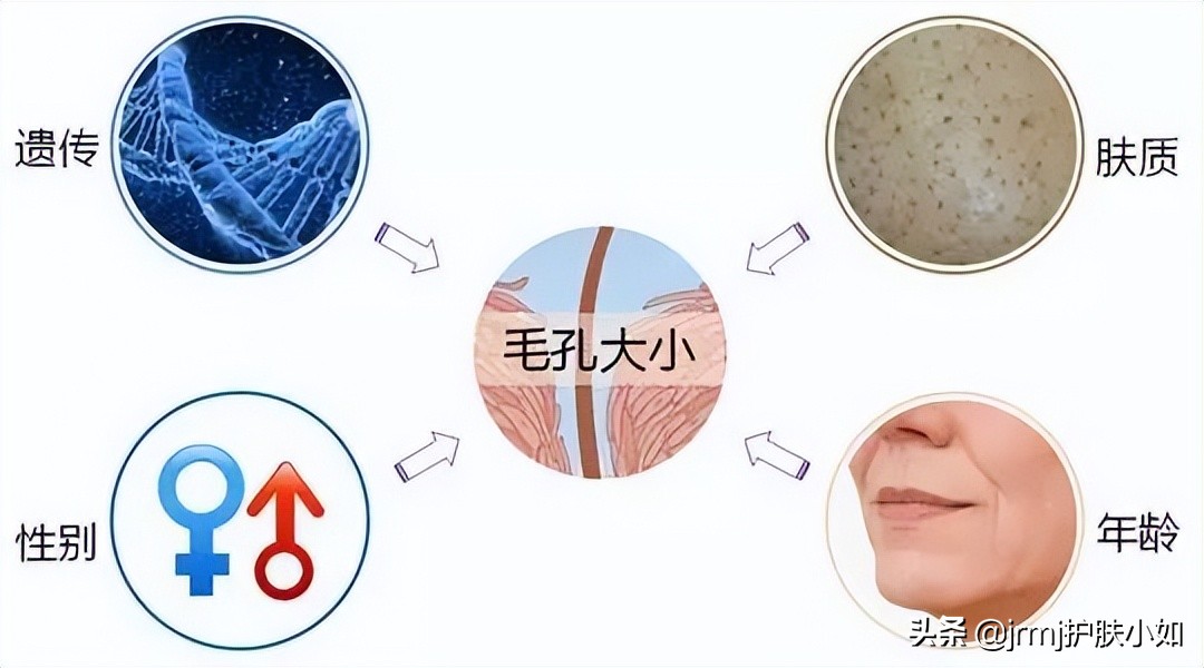 毛孔粗大收缩毛孔做什么医美项目,医美收缩毛孔能达到什么效果