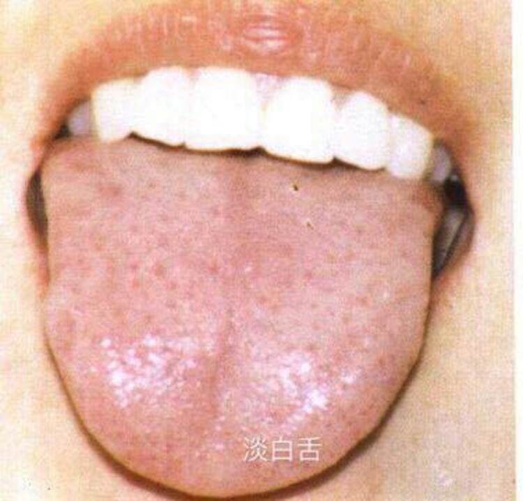 血虚血热血燥方剂,血虚血热血寒血瘀