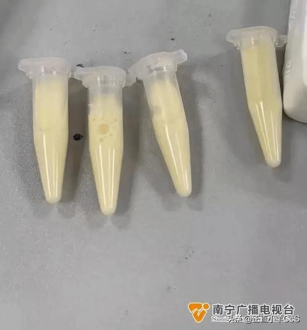 广西37岁孕妇,37岁广西孕妇