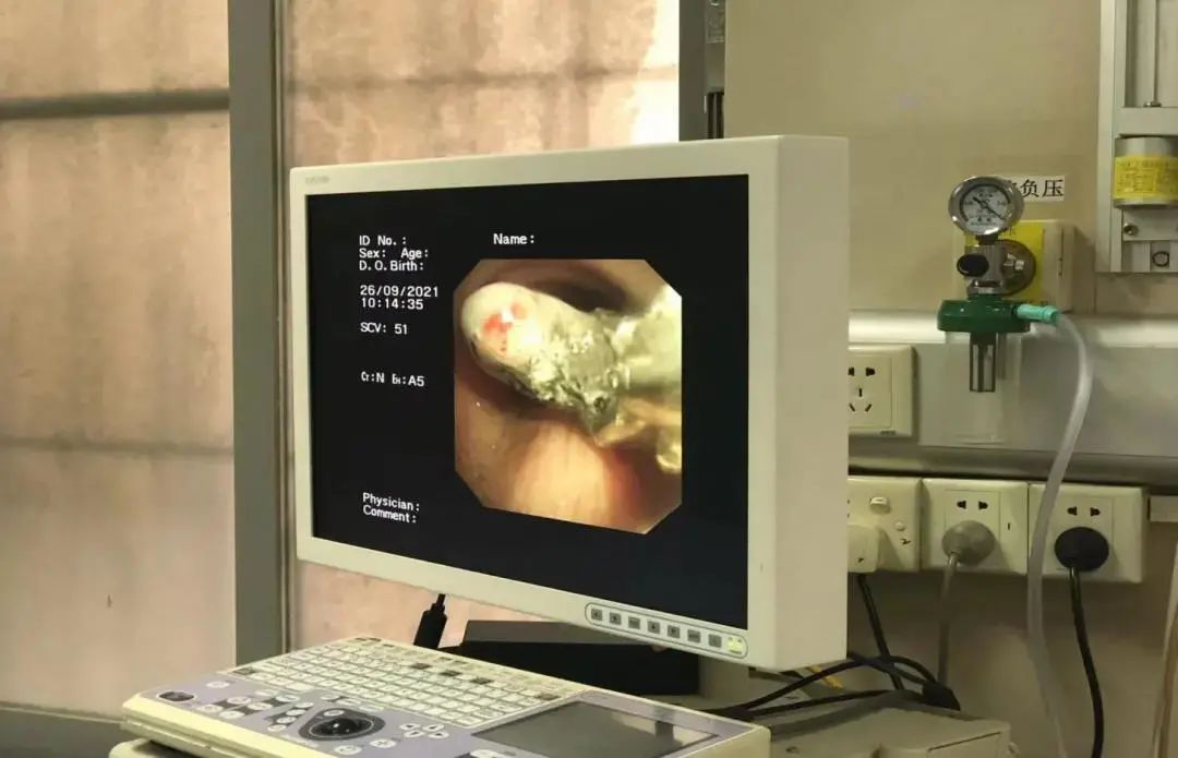 喉管长了一个包怎么办,气管里总长痰栓怎么治疗