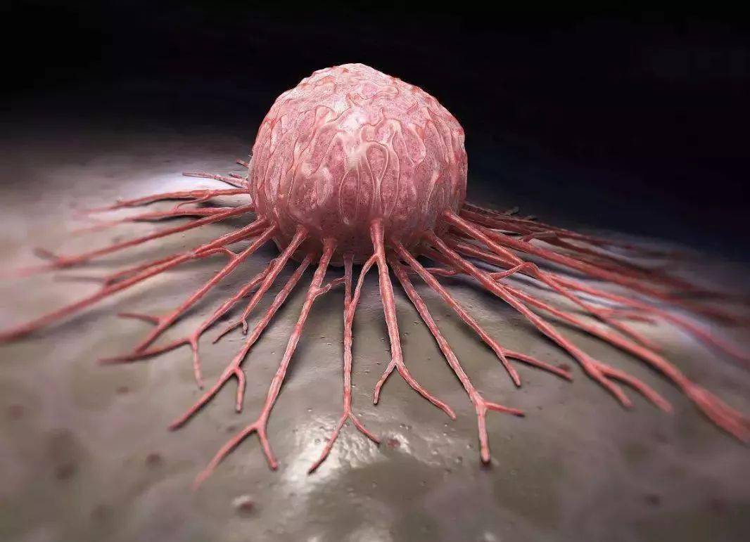 腹腔镜肾切除示意图,腹腔镜肾脏部分切除术