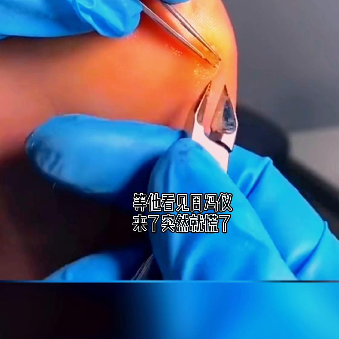 小说推文,小说推文ai视频生成工具