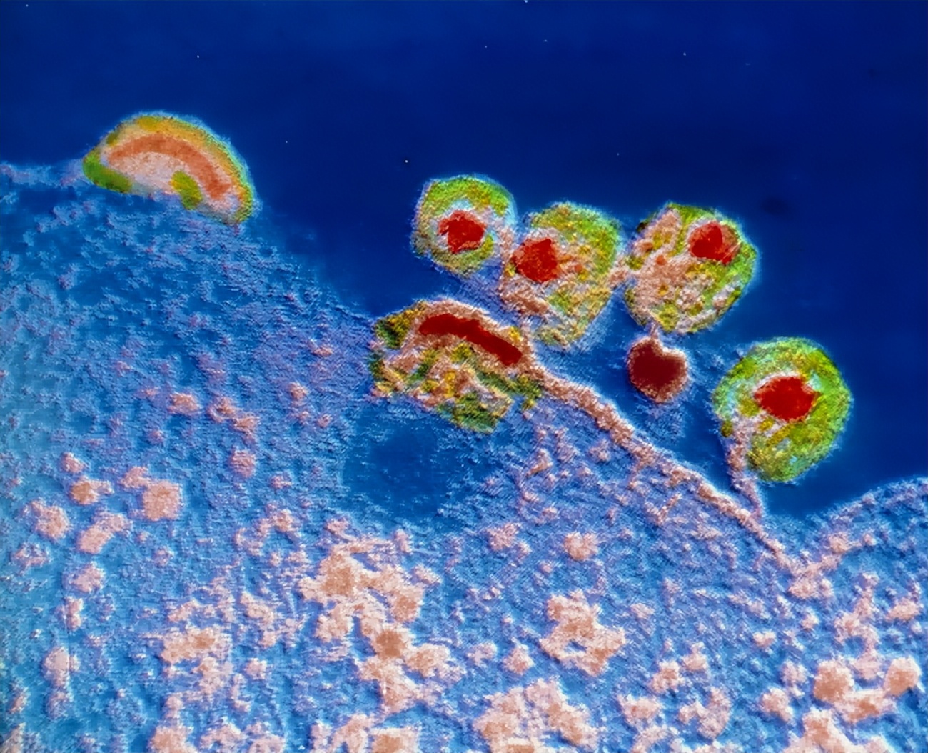 为什么非洲是艾滋病高发地？看完当地人的生活，就懂了