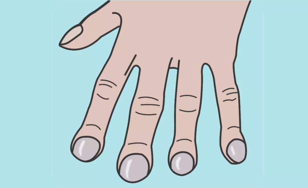 指甲出现异常是肝上出问题了吗,口苦口臭指甲竖纹是肝的问题吗