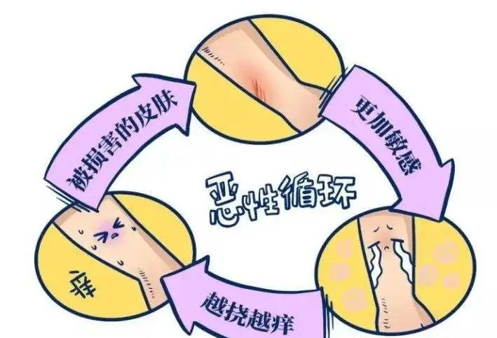 医生发痒的症状有哪些,患者全身无症状的痒是怎么回事