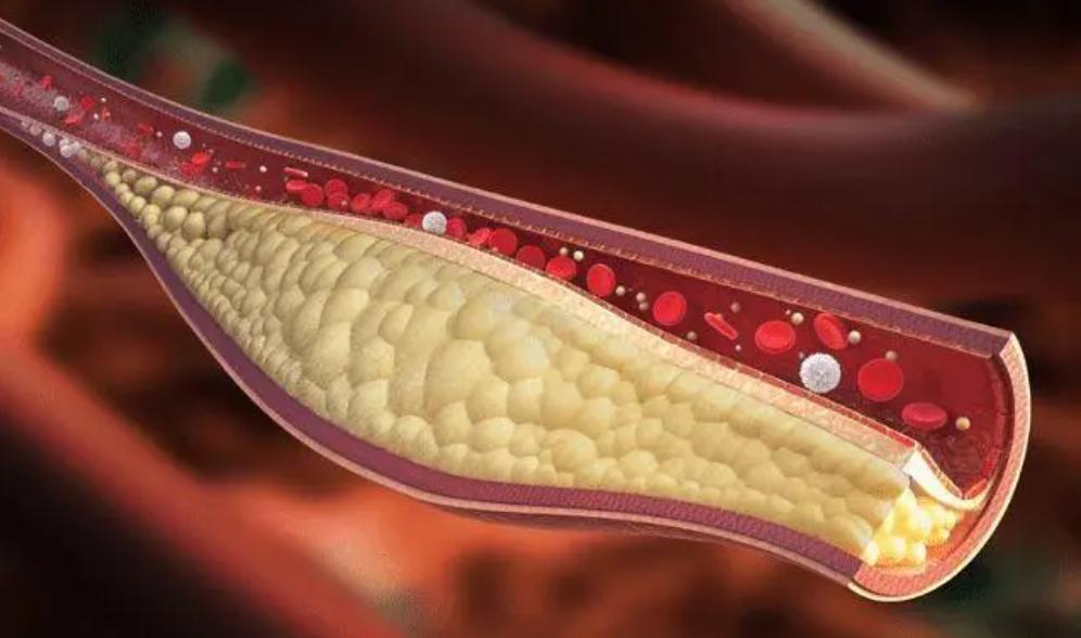 治疗阳痿缺哪种营养,年纪轻轻阳痿怎么治