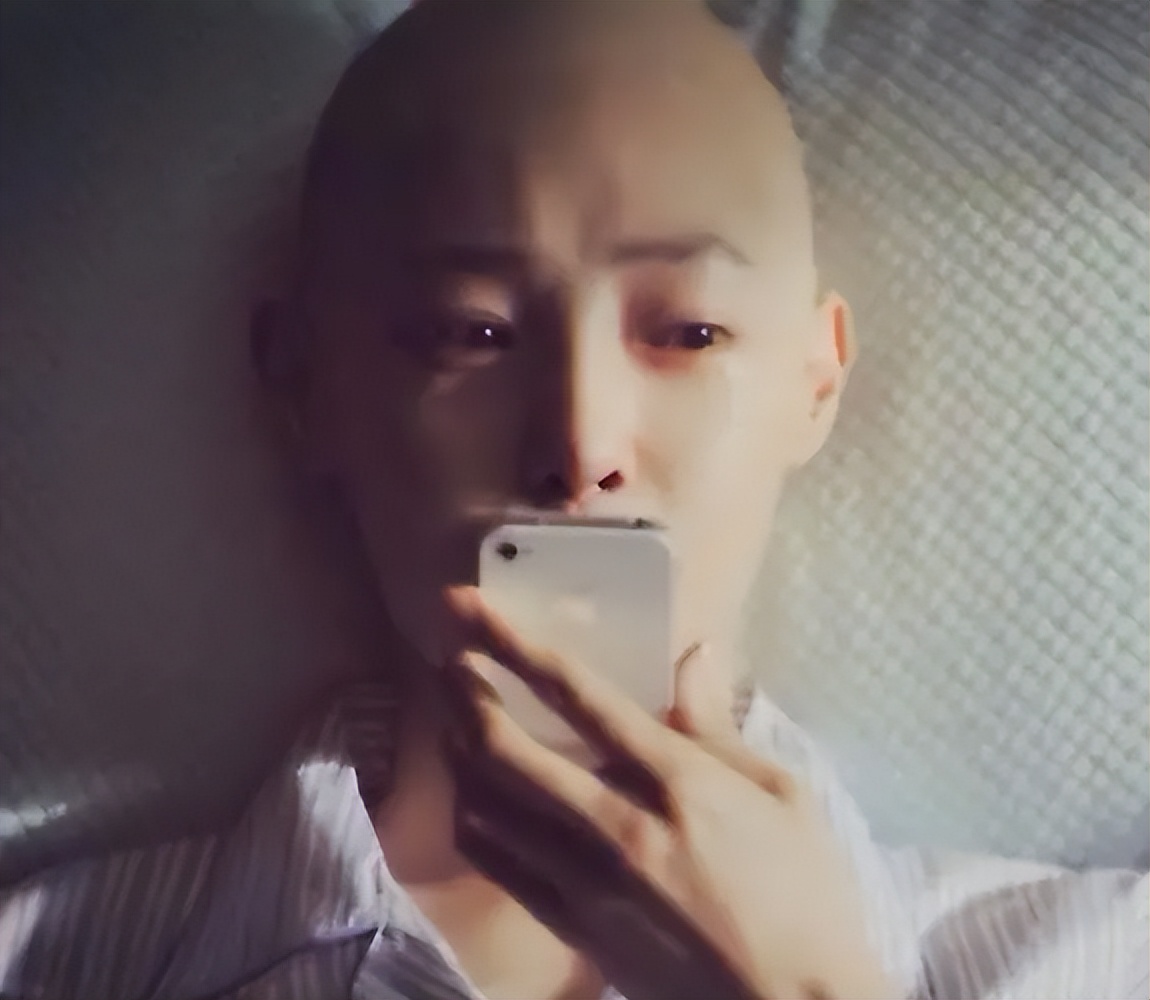 化疗后头发长得很稀疏怎么办,化疗后头发掉完了怎么办