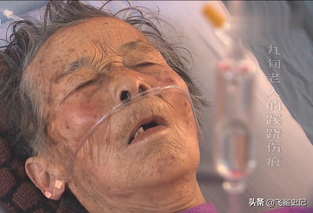 母亲被火灾烧伤,母亲被火烧死后续