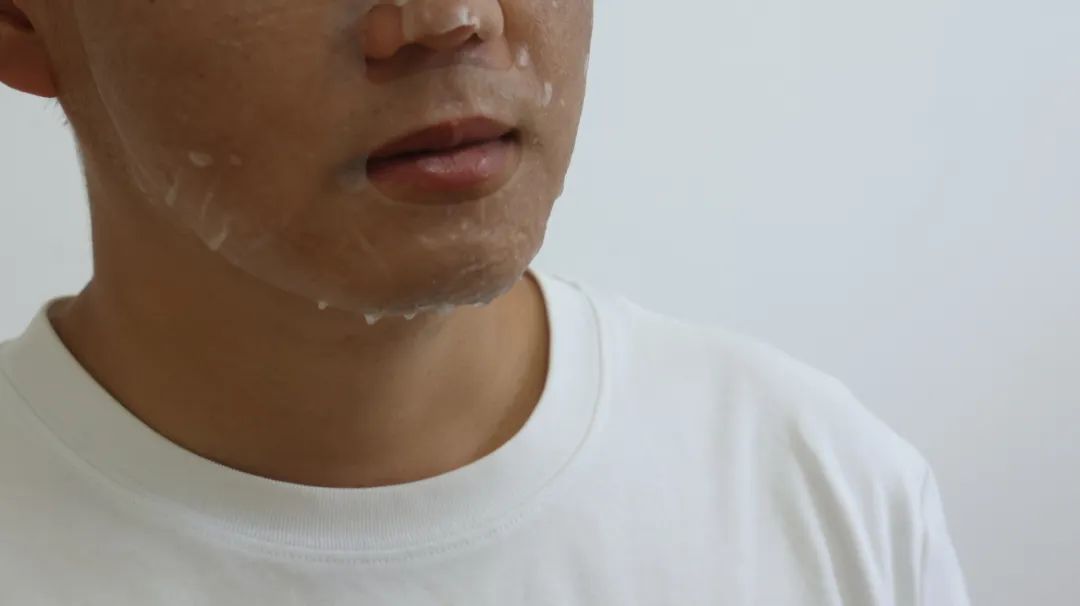 脸部皮肤经常掉皮怎么办,脸干燥掉皮怎么补水最快