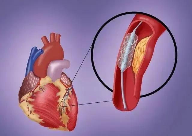 为什么中国不禁使用反式脂肪酸,全世界哪几个国家禁止反式脂肪酸