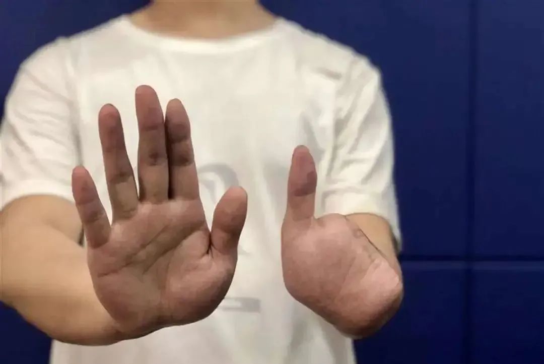 怀孕两月女子被骗到缅甸，她为何不怕被噶腰子？