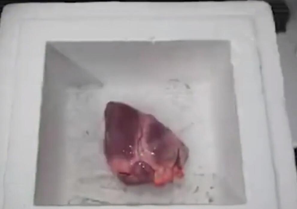 *奴性***女妓**，奴隶，备用*体器人官**库，那些骗走的人口在国外的遭遇。