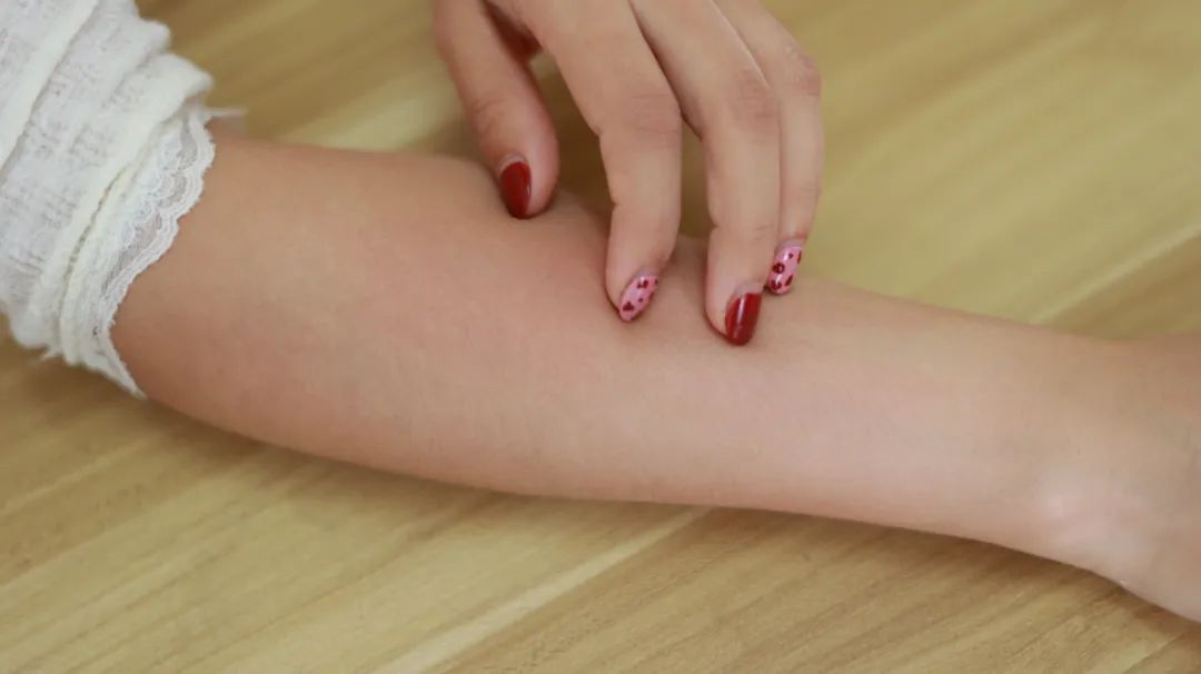 湿疹反复发作该如何应对,湿疹是什么原因造成的要怎么预防