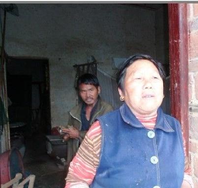 男子手长满树疙瘩是什么病,男子手长满树疙瘩手术了吗