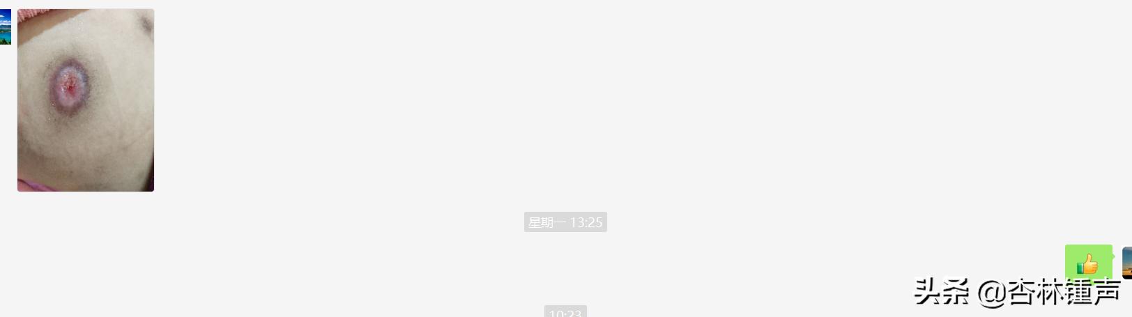 西医无法治愈的疾病被中医治好,你身边有没有被中医治好的案例