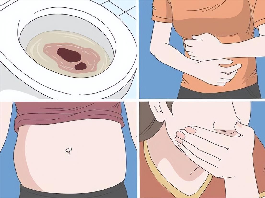 香丹清是治疗便秘还是缓解便秘,麻子仁丸是治疗便秘还是缓解便秘