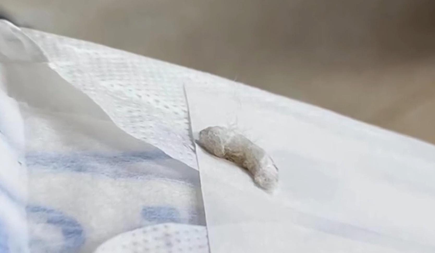 女子称卫生巾里有虫子,女子称卫生巾中发现虫