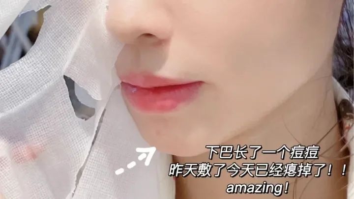 2021美白淡斑面膜十大排行榜口碑,祛痘印面膜真实测评有效第一名