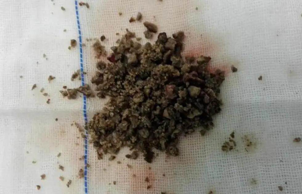 空腹吃柿子为什么会结石,空腹食用柿子当心结石作怪