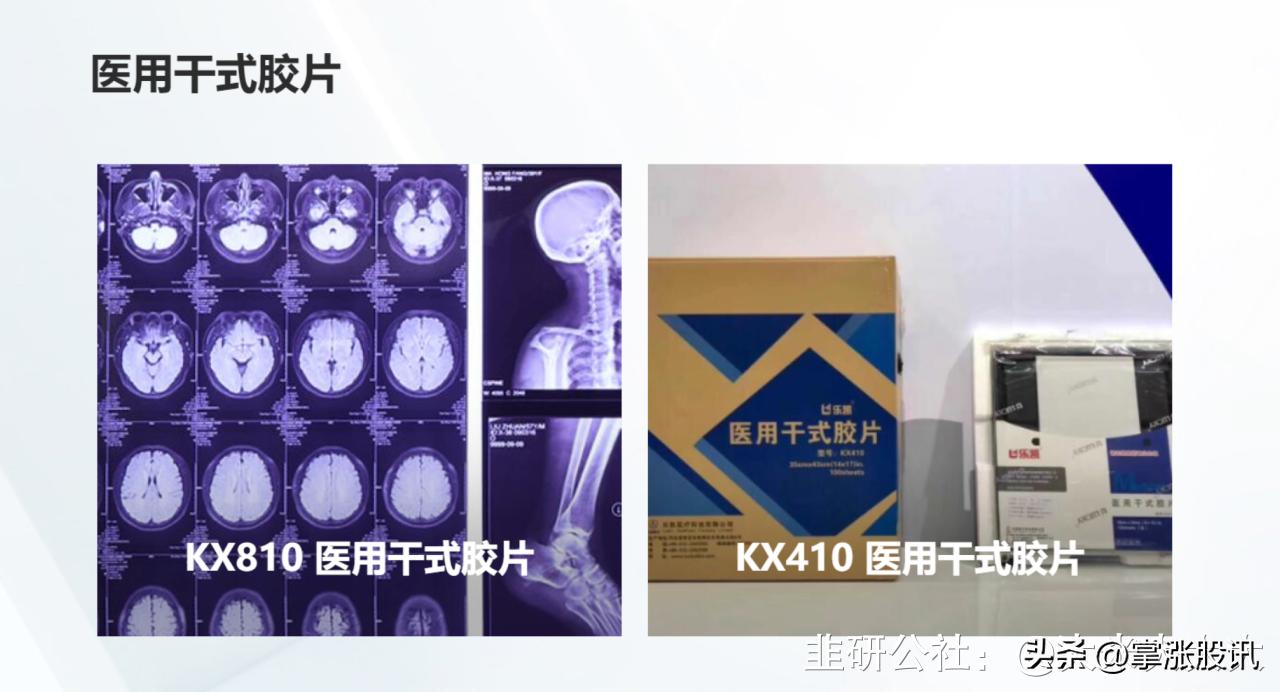 肺部ct检查有胶片的吗,现在肺部ct还有必要取胶片吗