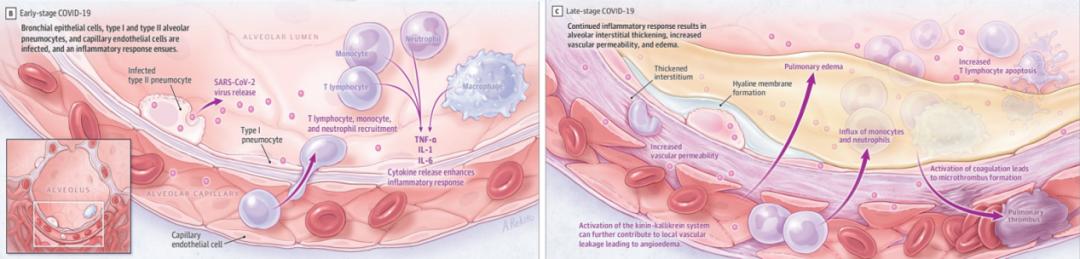 宋元林教授：「脆弱人群」即便打过疫苗，病毒仍能突破免疫屏障