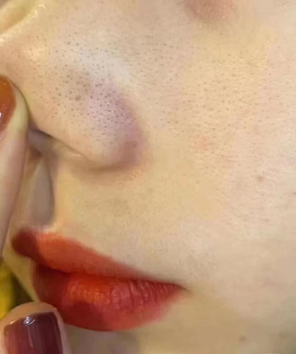 抗老抗黄精华排行榜,40岁抗皱美白精华搭配